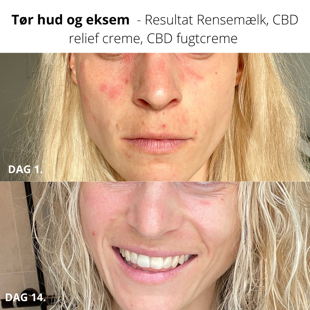 Anti-rødme CBD Ansigtscreme, Økologisk