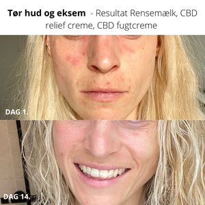 Anti-rødme CBD Ansigtscreme, Økologisk