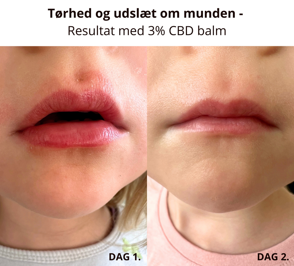 Lindrende 3% CBD-Balm, Økologisk