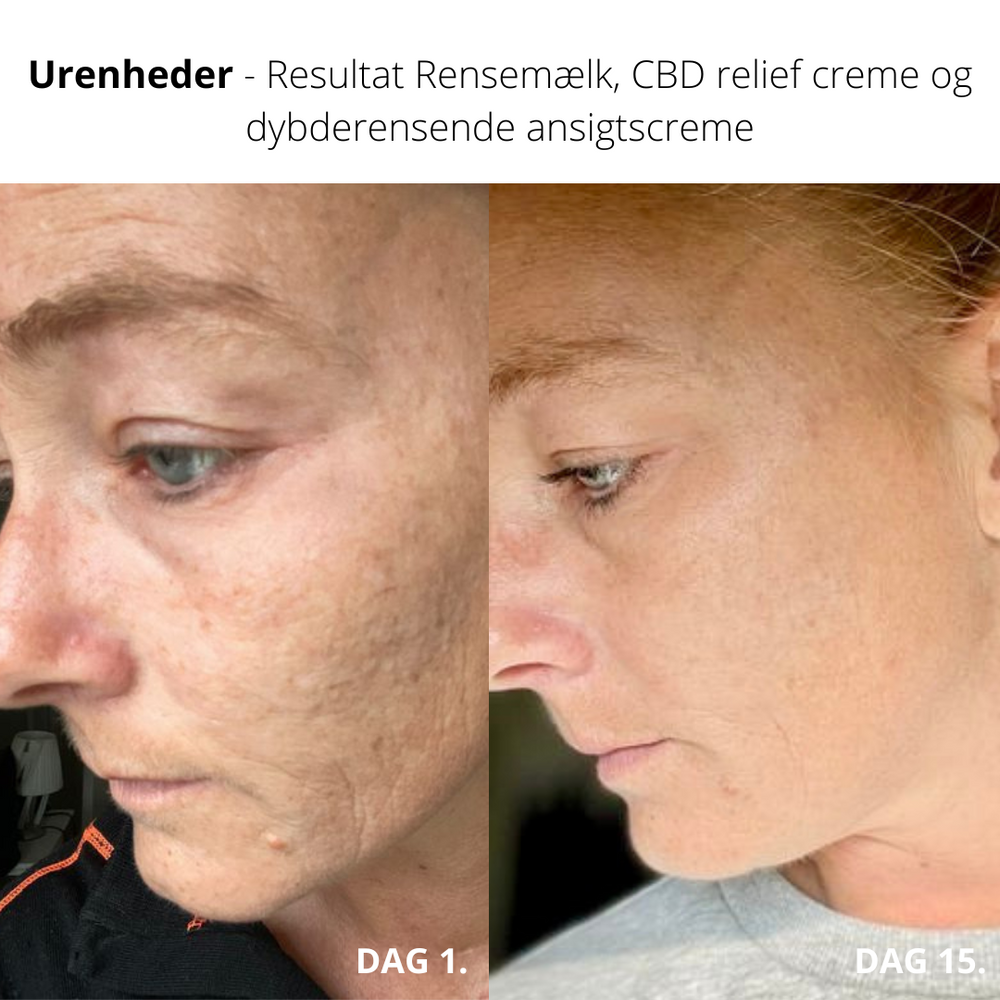 
            
                Load image into Gallery viewer, CBD extended relief creme, Økologisk
            
        